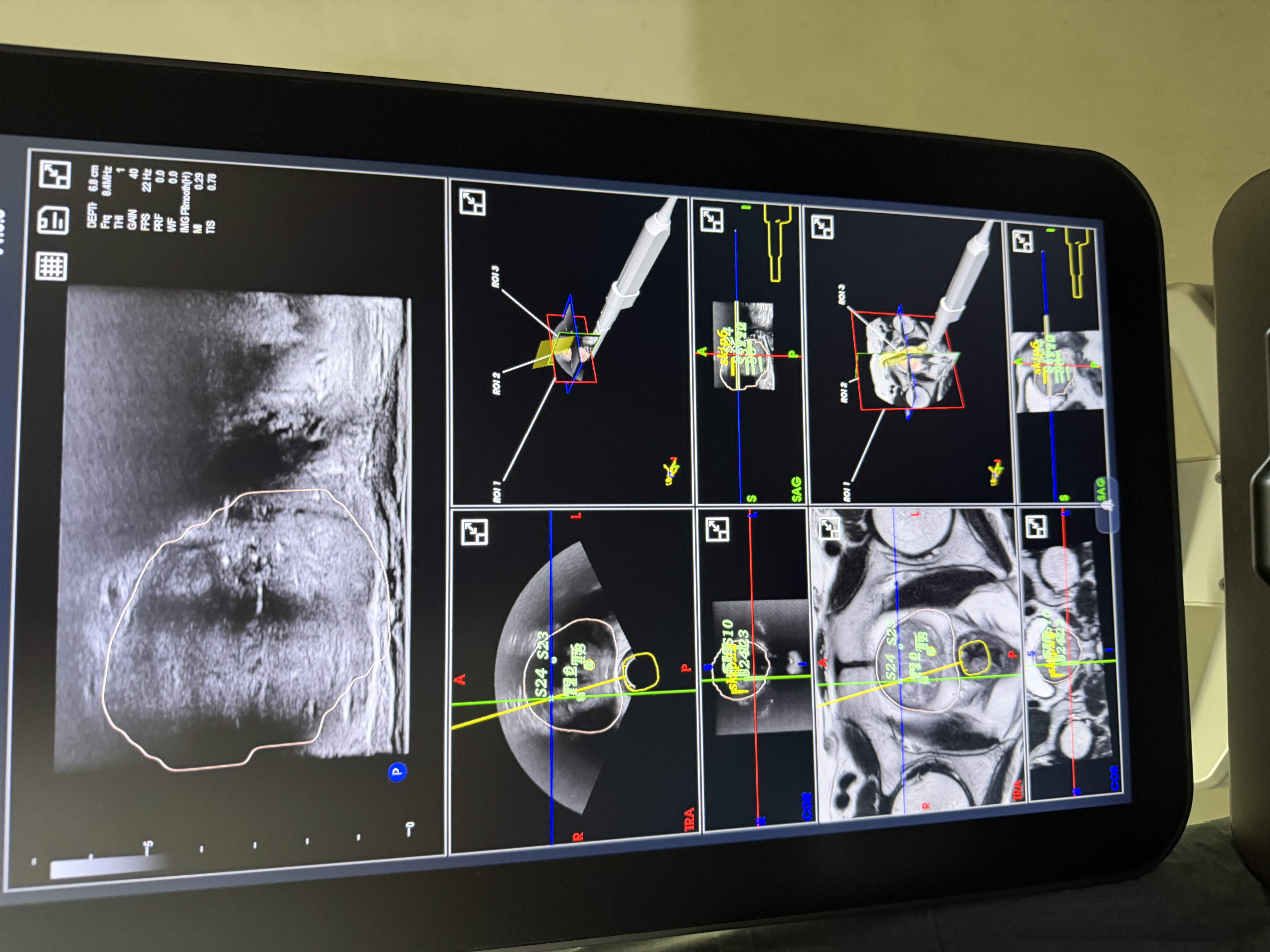 Dr. Paulo Guinto Urology photo 2